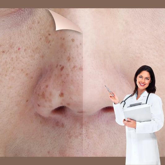 How to get rid of Dark Spots fast: The Best Hyperpigmentation Treatment