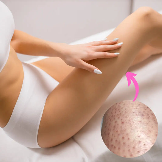 4 Natural Ways to Get Rid of Ingrown Hairs & Razor Bumps